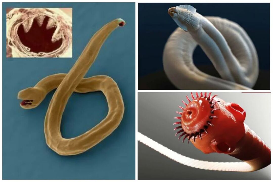 tipuri de viermi din organism